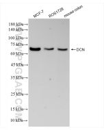 Decorin Recombinant monoclonal antibody Proteintech  83753-4-RR