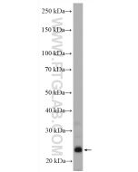 Endothelin 1 Polyclonal antibody Proteintech  12191-1-AP