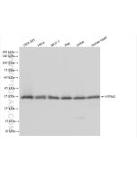 HTRA2 Recombinant monoclonal antibody Proteintech  83492-7-RR