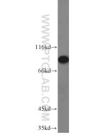 RRM1 Polyclonal antibody Proteintech  10526-1-AP