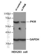 PKM Polyclonal antibody Proteintech  10078-2-AP