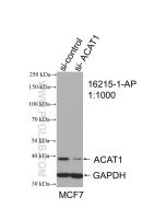 ACAT1 Polyclonal antibody Proteintech  16215-1-AP