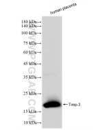 Timp-3 Recombinant monoclonal antibody Proteintech  83627-1-RR