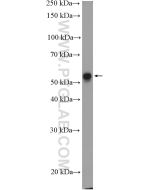 Cytokeratin 6A Polyclonal antibody Proteintech  10590-1-AP