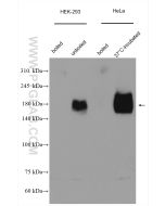NPC1 Polyclonal antibody Proteintech  13926-1-AP