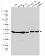 Cytokeratin 18 Polyclonal antibody Proteintech  10830-1-AP