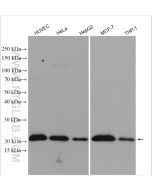 P21 Polyclonal antibody Proteintech  10355-1-AP