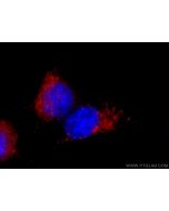 Anti-Mouse CD107b / LAMP2 (ABL-93) Proteintech  65052-1-Ig