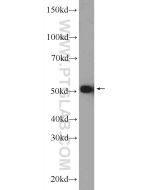 HNRNPK Polyclonal antibody Proteintech  11426-1-AP